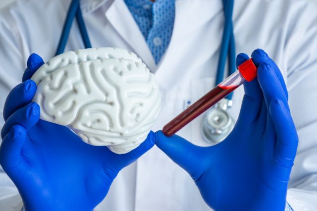 laboratory technician holds in one hand laboratory test tube with blood, in other brain model