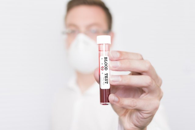 Ein männlicher Wissenschaftler/Arzt hält ein Reagenzglas mit der Aufschrift „Bluttest“ mit eingekreister Gruppe AB.