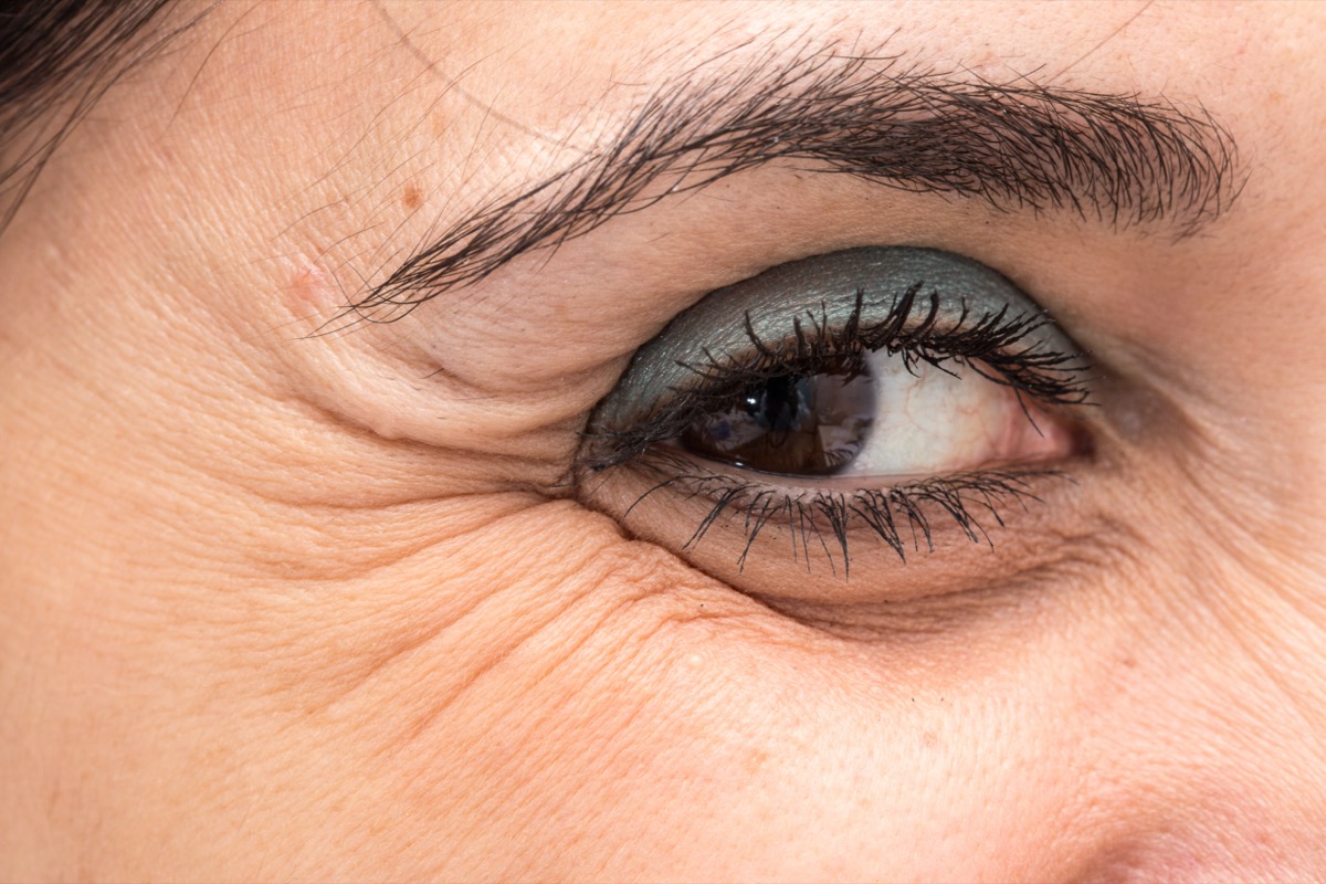 Woman's eye with crow's feet shows skin signs of aging.