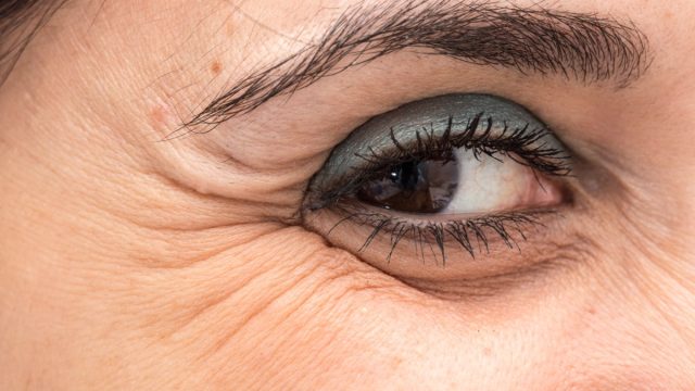 Woman's eye with crow's feet shows skin signs of aging.