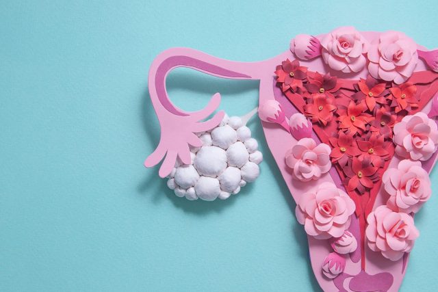 polycystic ovary syndrome