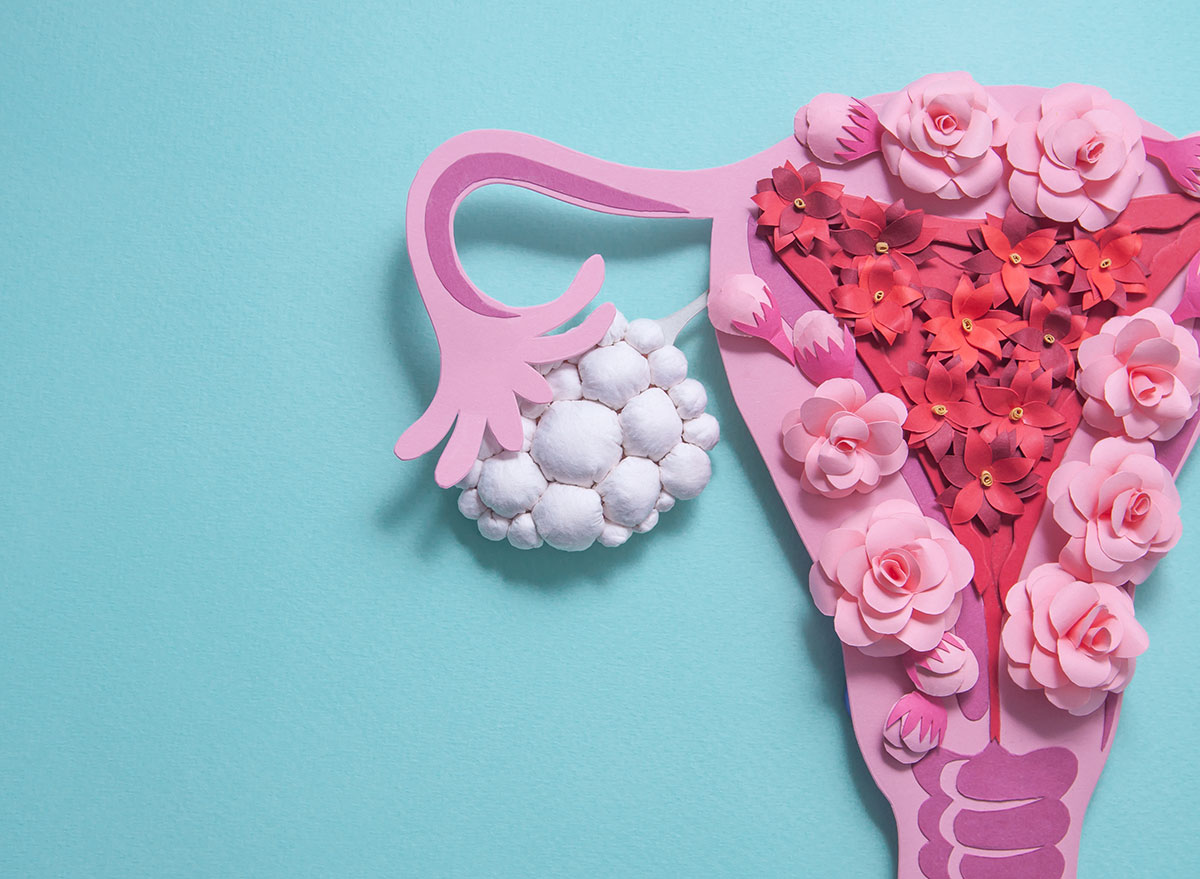 Polycystic ovaries What Doctors Don't Tell You