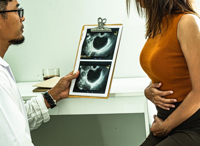 xray uterus