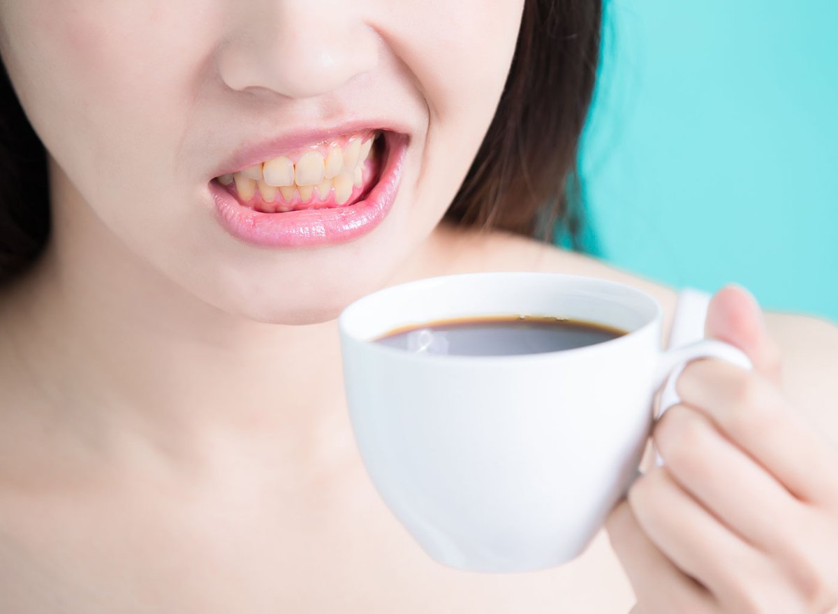 Coffee stained teeth