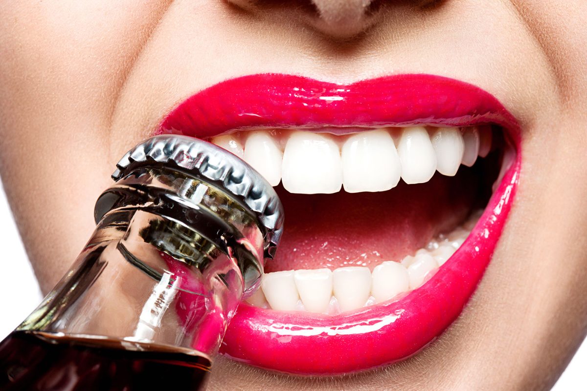 Soda teeth