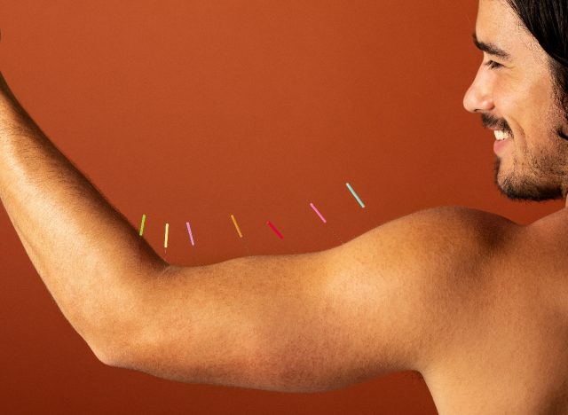 man with colorful acupuncture needles in his arm