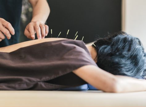Here's How Acupuncture Can Improve Your Gut Health
