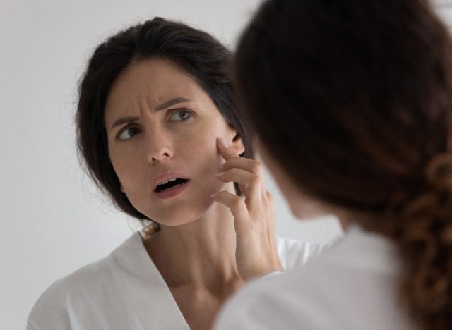 woman pointing at pimple on face, wondering what causes acne