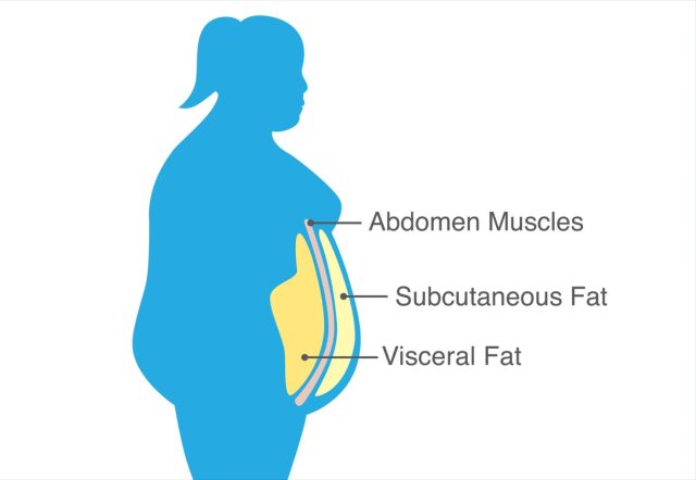 Visceral fat and subcutaneous fat that accumulate around waistline of woman.