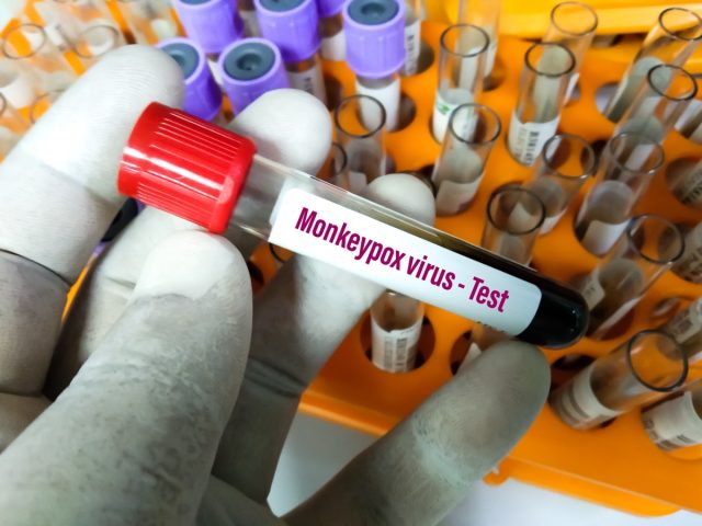 Blood sample tube for Monkeypox virus test.