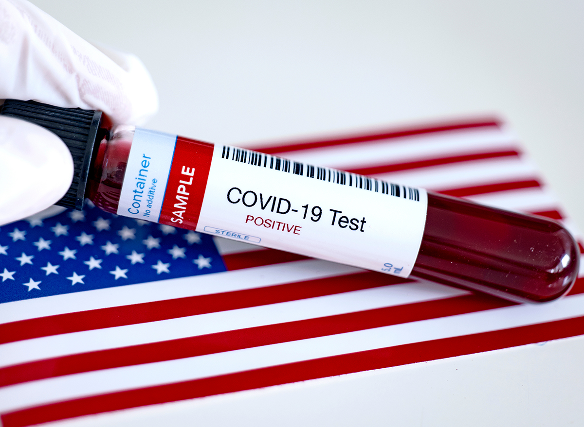 Testing,For,Presence,Of,Coronavirus.,Tube,Containing,A,Blood,Sample, Covid, USA, United States