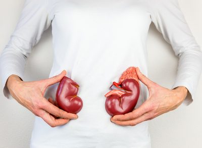 Showing kidneys