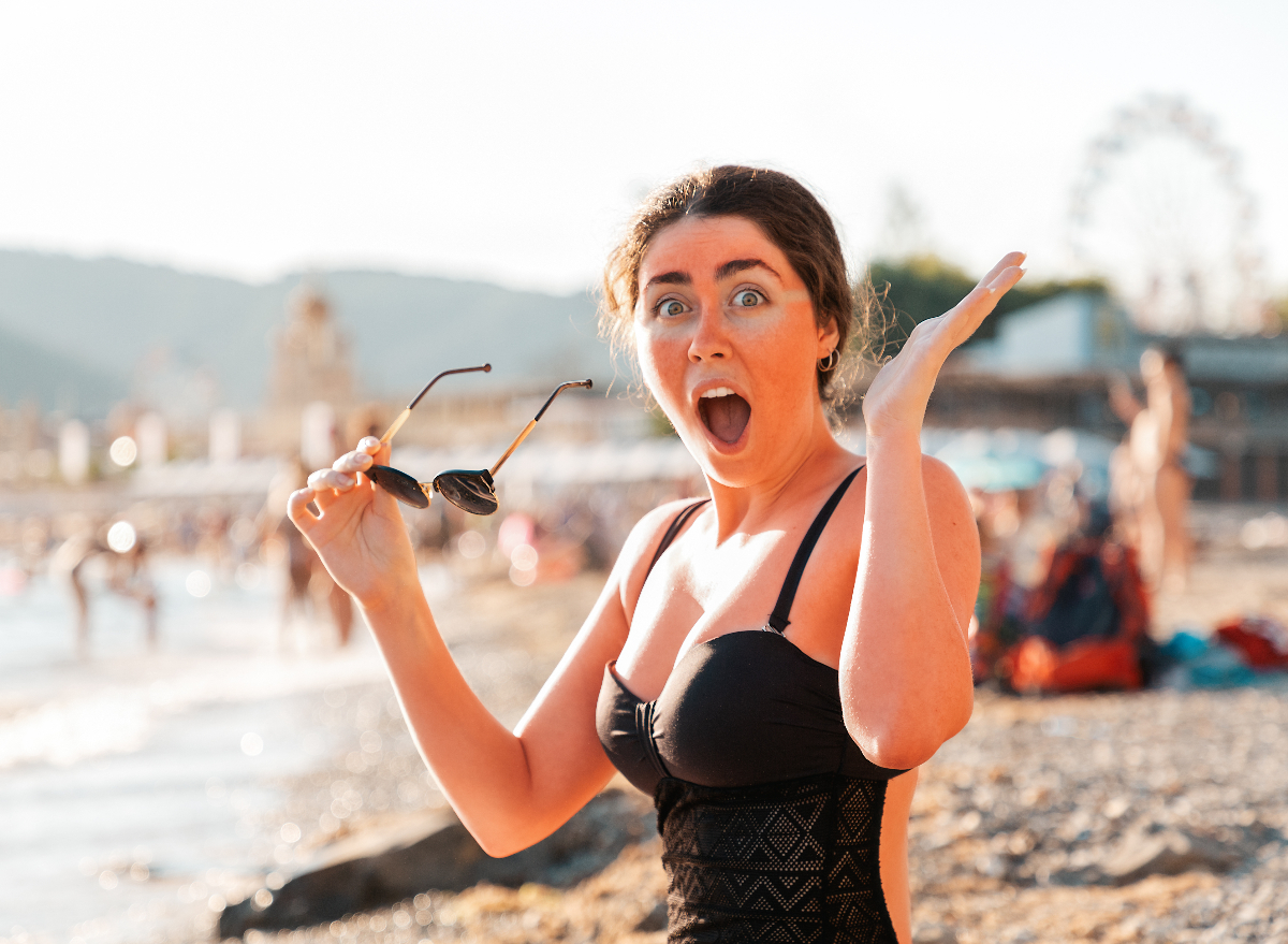 woman with sunburned skin on beach, concept of how to relieve discomfort from sunburn