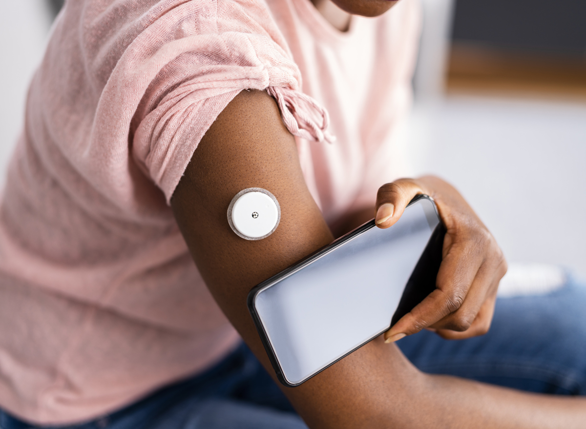 continuous glucose monitoring