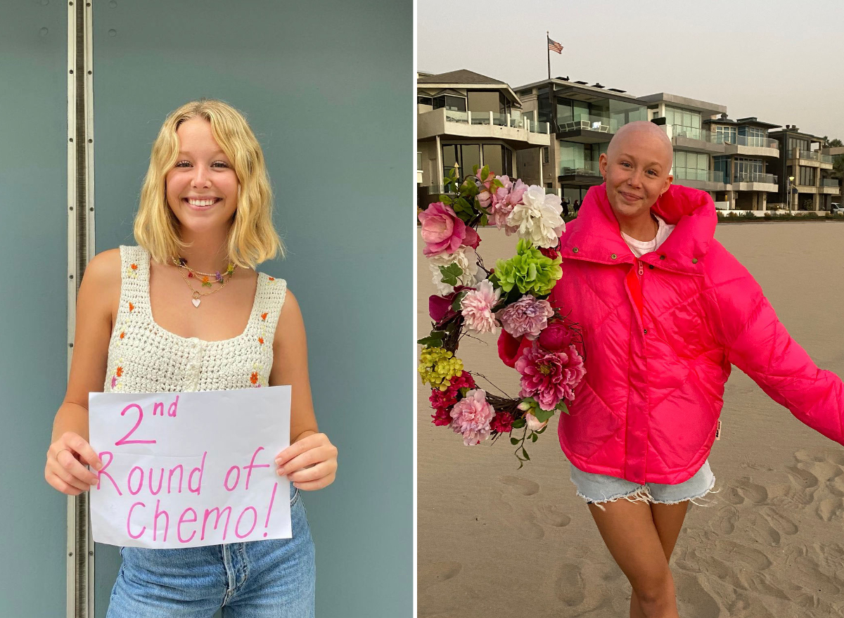 Miranda McKeon breast cancer journey split image