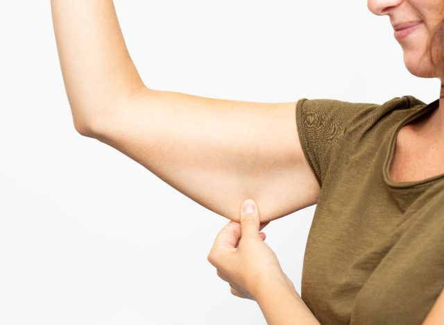 woman pulling down arm flab