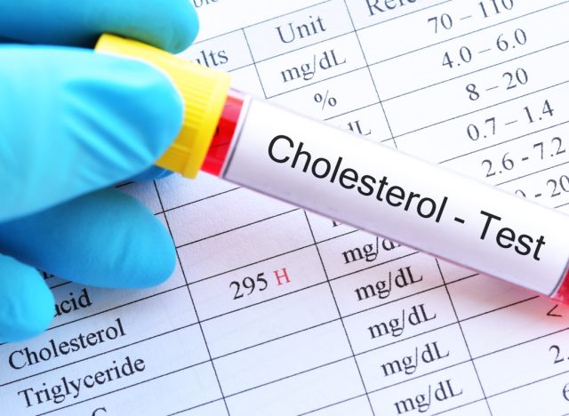 High Levels of ‘Bad Cholesterol’ Associated With Greater Dementia Risk, New Study Finds