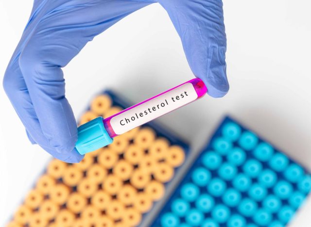 positive high cholesterol test concept