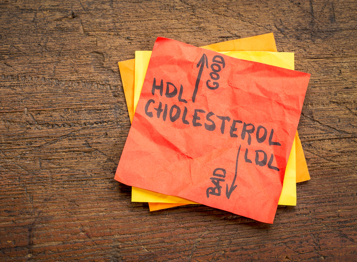 high hdl ldl cholesterol