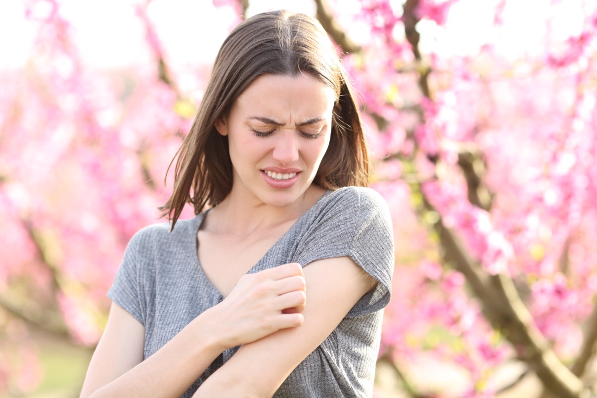 Stressed,Woman,Scratching,Itchy,Arm,After,Insect,Bite,In,A