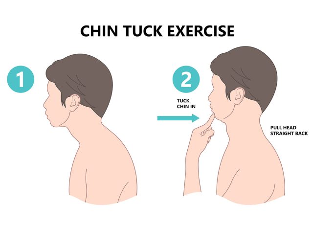 Chin Tuck Head Text neck lift pain nerve deep flexor spine inflamed bad correct poor good phone smart tablet laptop use work from home chiropractor strain upper back Jaw Joint outlet stress injury