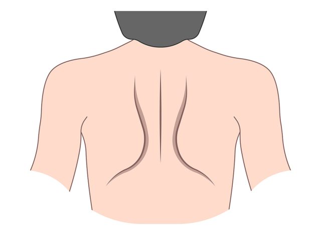 hot pack joint palsy pain range of motion rotator cuff spine neck blade relief winging back test