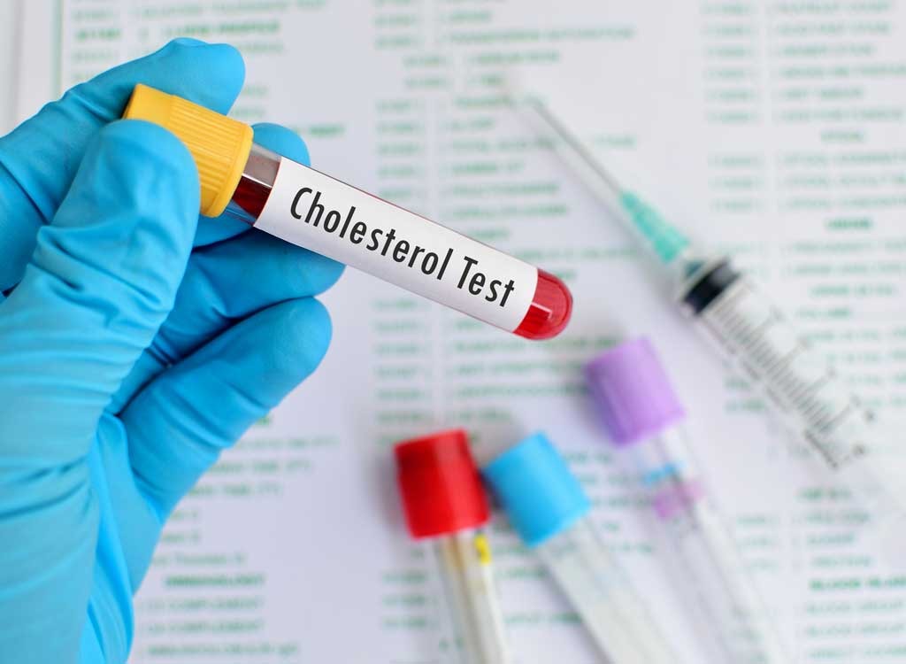 Cholesterol Test