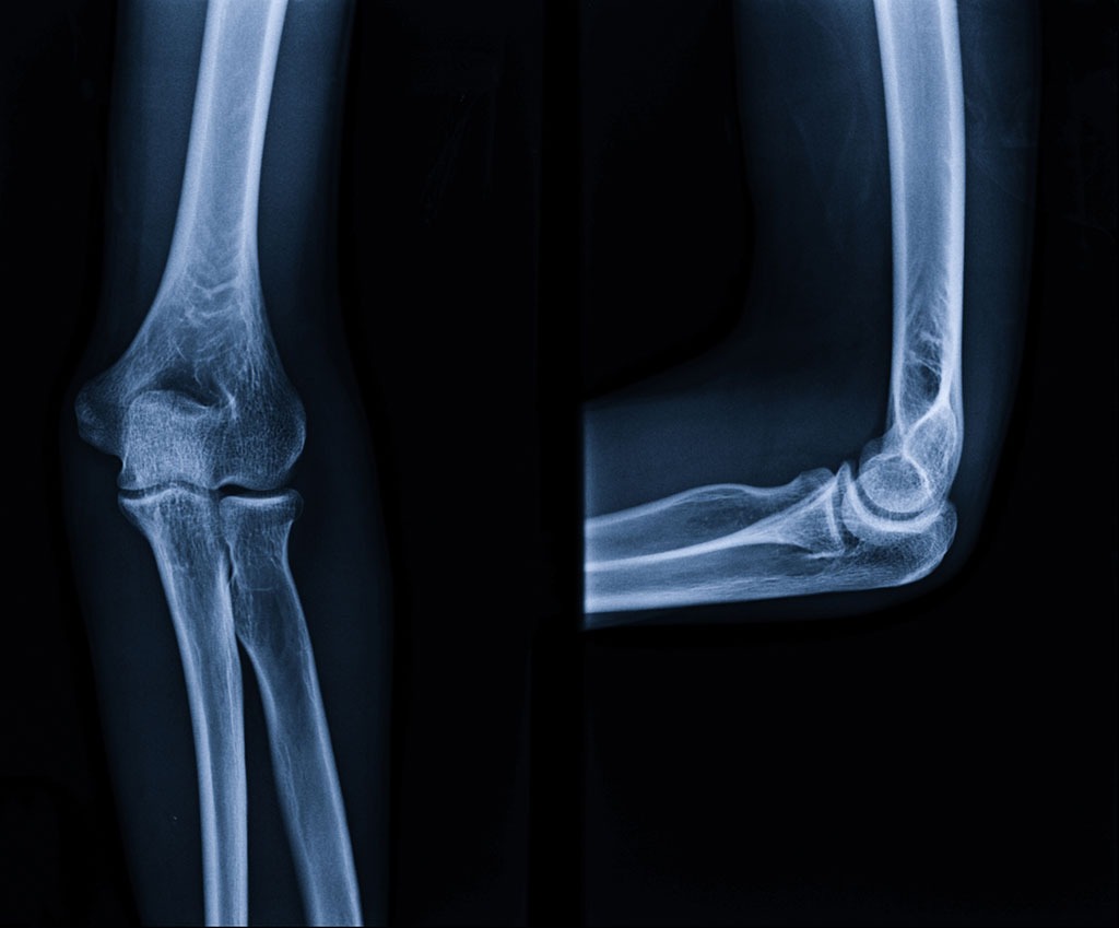 What Happens to Your Body After Drinking Soda Eat This, Not That!