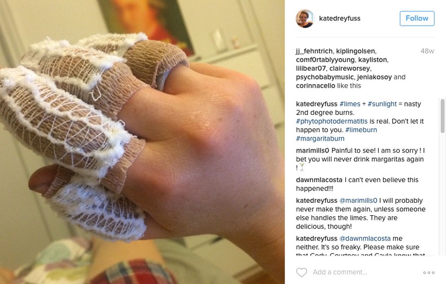 What the Heck Is a Margarita Burn? Eat This Not That